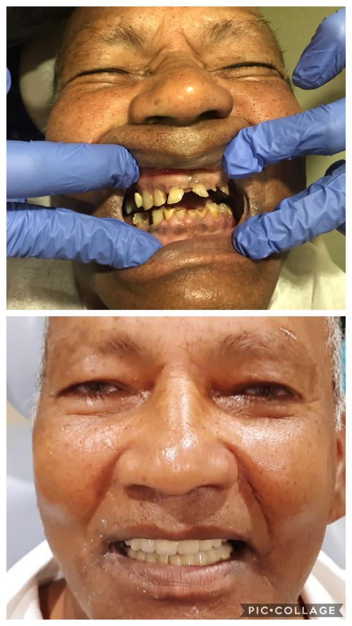 Smile transformation