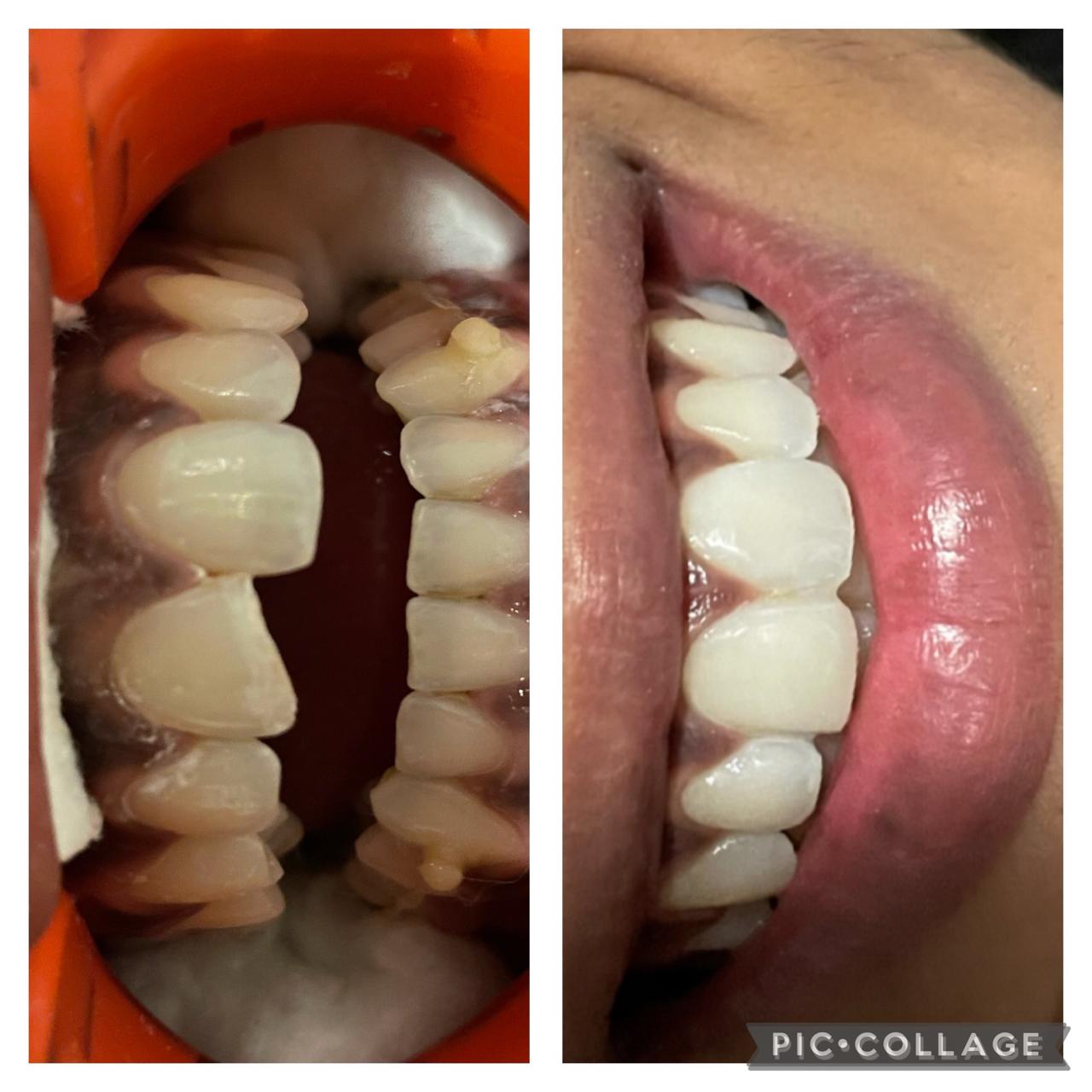Smile transformation