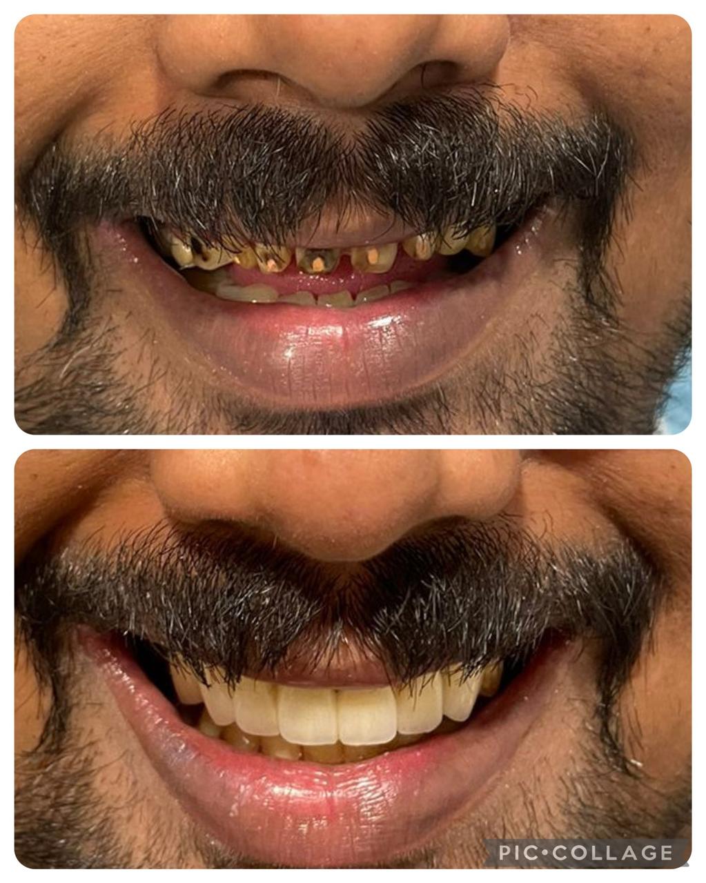 Smile transformation